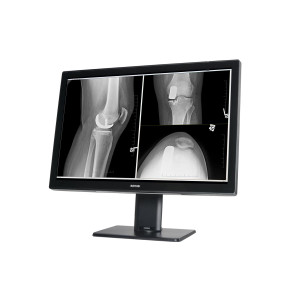 Barco Coronis Fusion 6MP, Diagnostic, With protection (MDCC-6530) 