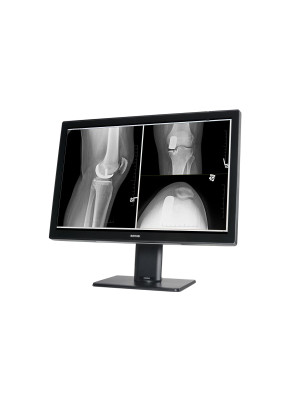 Barco Coronis Fusion 6MP, Diagnostical, With protection (MDCC-6530) 